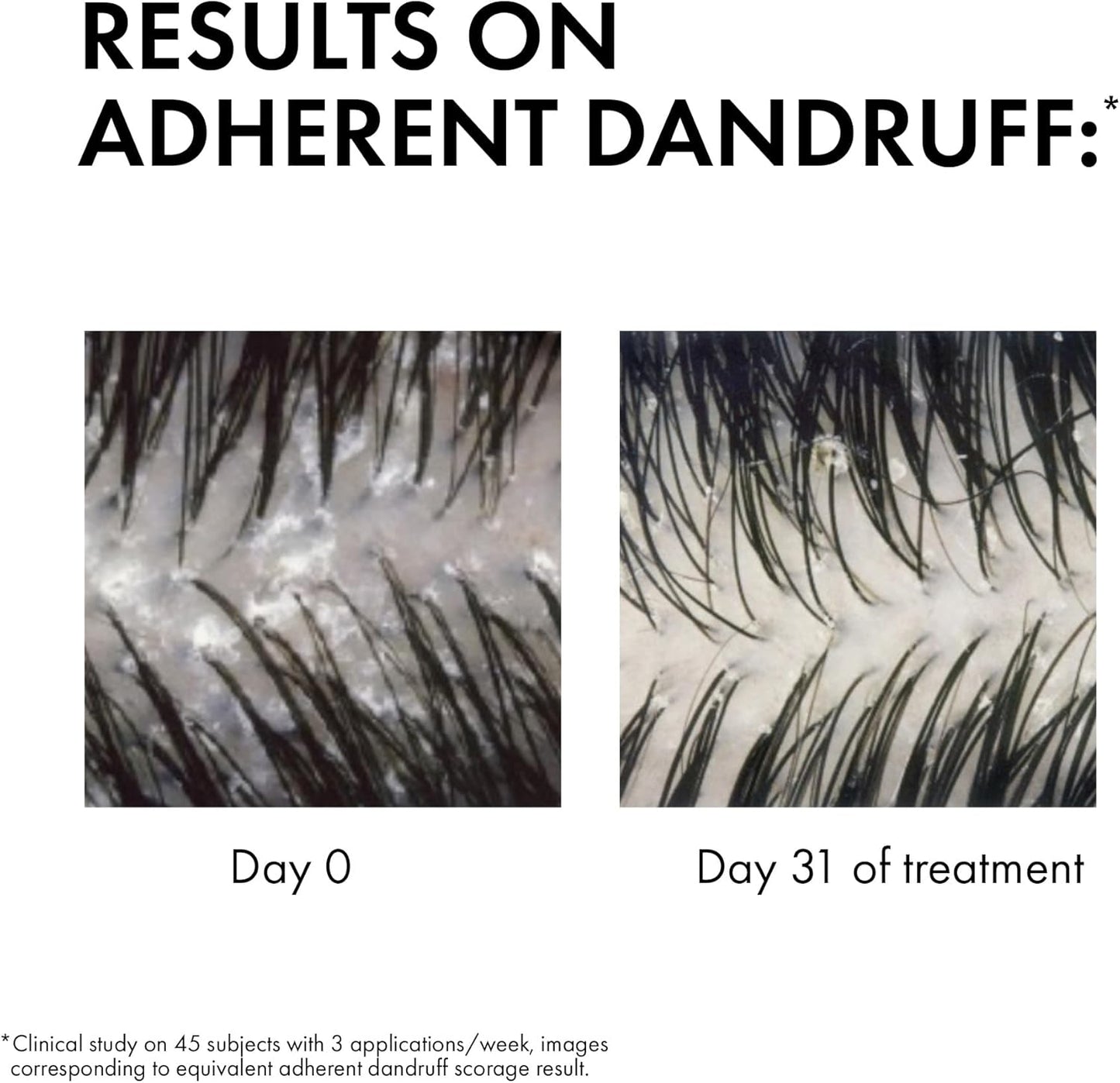 Vichy Dercos, Shampoo Trattamento Anti-Forfora, per Capelli Secchi, Allevia Senso Di Prurito, Forfora Visibile Ridotta, Arricchito Con Disolfuro Di Selenio, 390 Ml